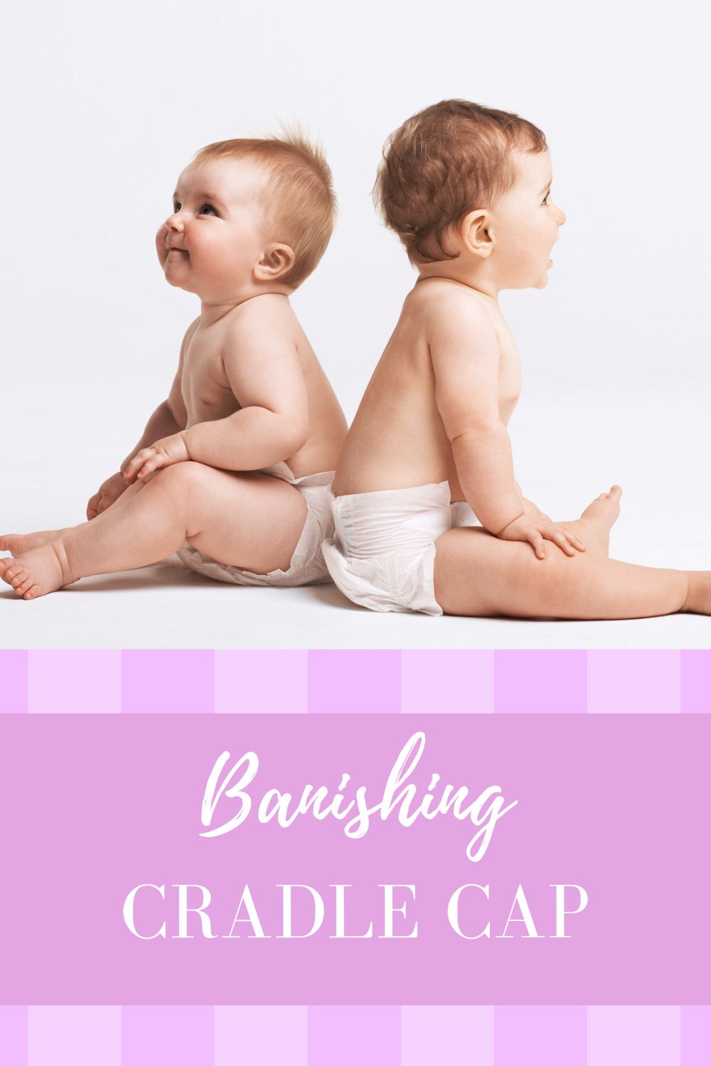Banishing Baby Cradle Cap for Good