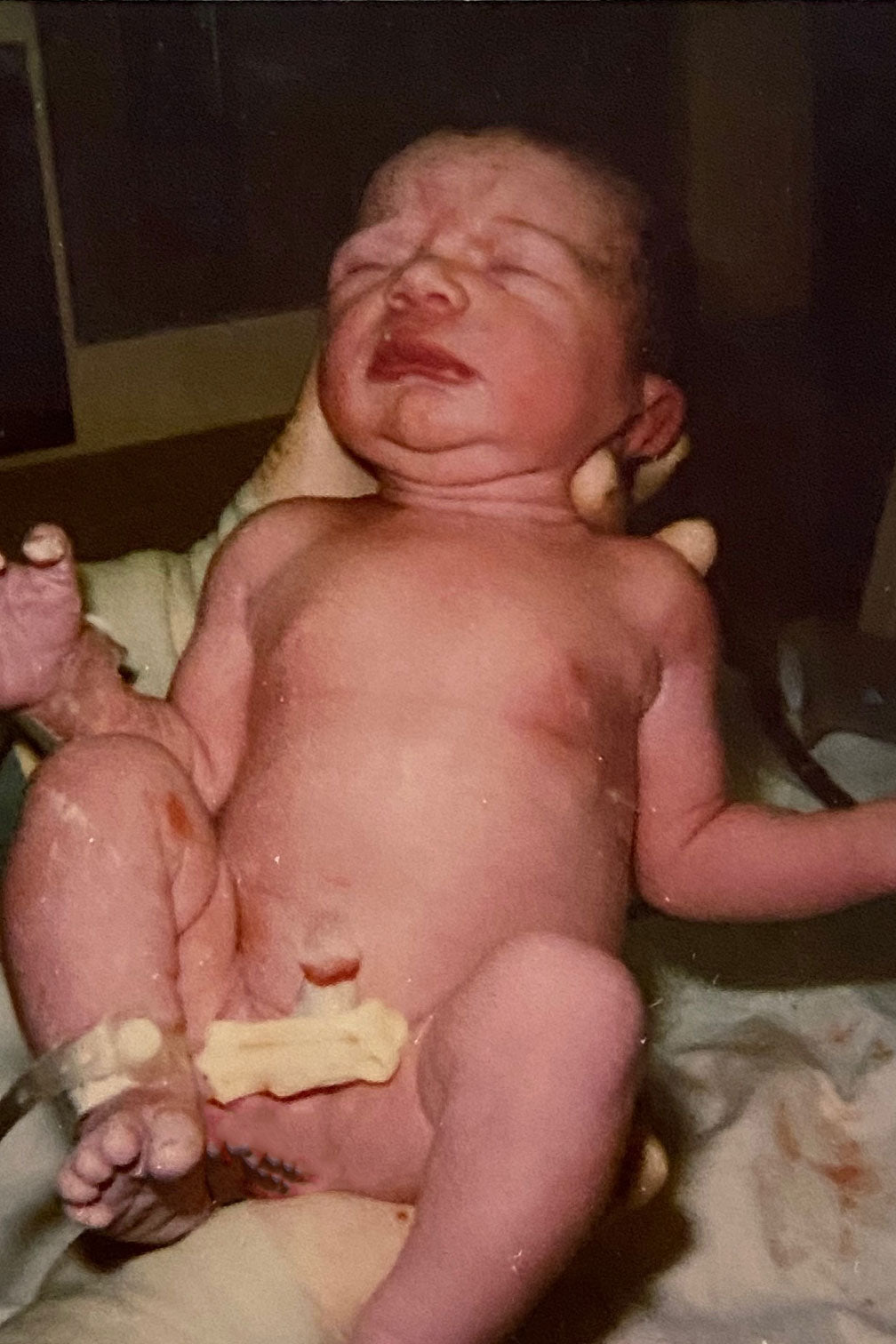 Umbilical Cord Care for Newborns